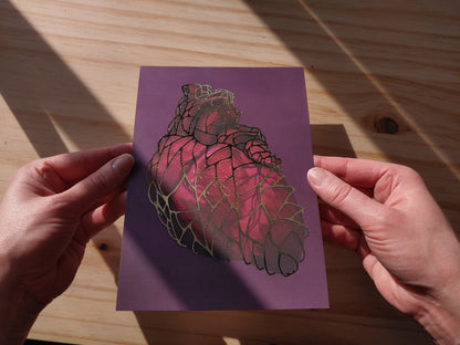 Heart of Gold Gilded Art Print