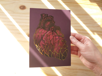Heart of Gold Gilded Art Print